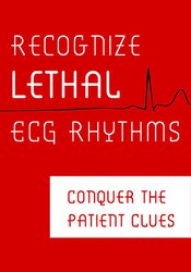 Recognize Lethal ECG Rhythms: Conquer the Patient Clues – Robin Gilbert